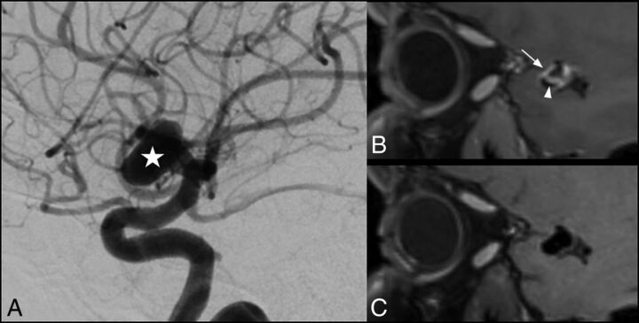 Fig 2.