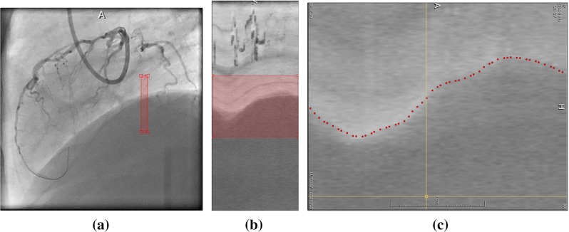 Fig. 2