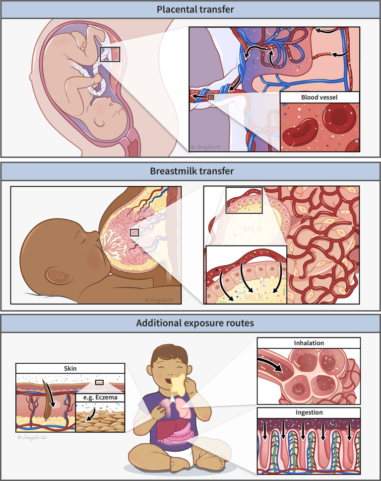 Figure 2 is an illustration having three steps showing early life exposure pathways to plastic particles. Throughout the image, plastic particles are shown around children, with arrows indicating potential routes of exposure. Step 1: Placental transfer. An image displays an infant inside mother’s womb. A close-up view depicting nano- and microplastic particles flowing through blood vessels and the umbilical cord is displayed. Step 2: Breastmilk transfer. An image displays an infant drinking milk from the breast. A close-up image of the milk inside the breast is displayed, with a potential transfer route of microplastics from a blood vessel into milk. Step 3: Additional exposure routes via skin, inhalation, and ingestion. On the left, a close-up image of skin showing plastic particles with an arrow indicating potential transfer via a hair follicle; a call-out showing chapped skin with eczema is also displayed. At the center, a toddler is sitting. On the right top, a close-up image of inhalation with microplastic particles in alveoli is displayed; and on the right bottom, ingestion is displayed with microplastic particles potentially transferring into the digestive tract.