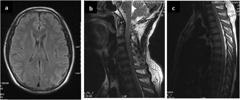 Fig. 3