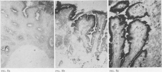 FIG. 8a-8c