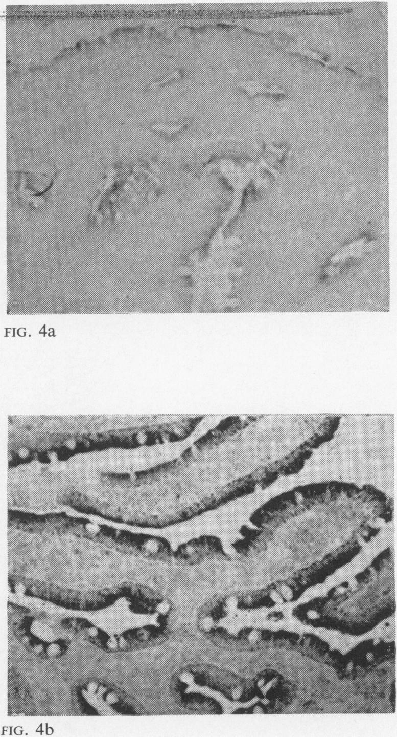 FIG. 4a-4b