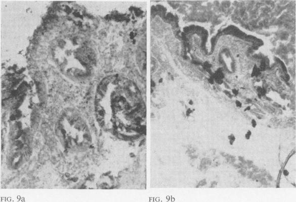 FIG. 9a-9b