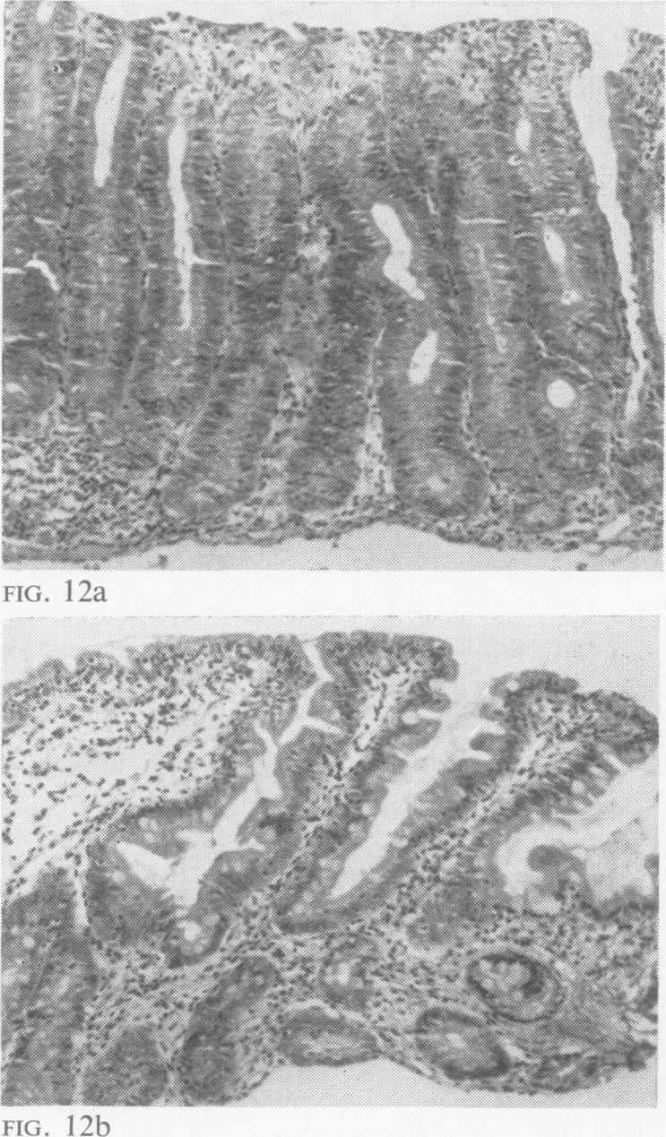 FIG. 12a-12b