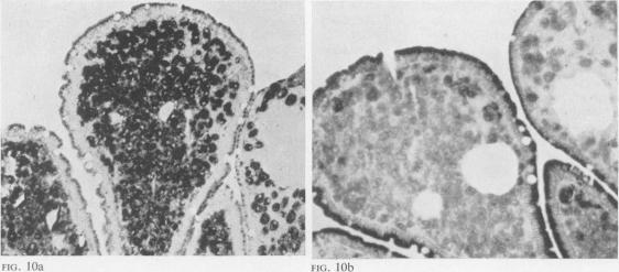 FIG. 10