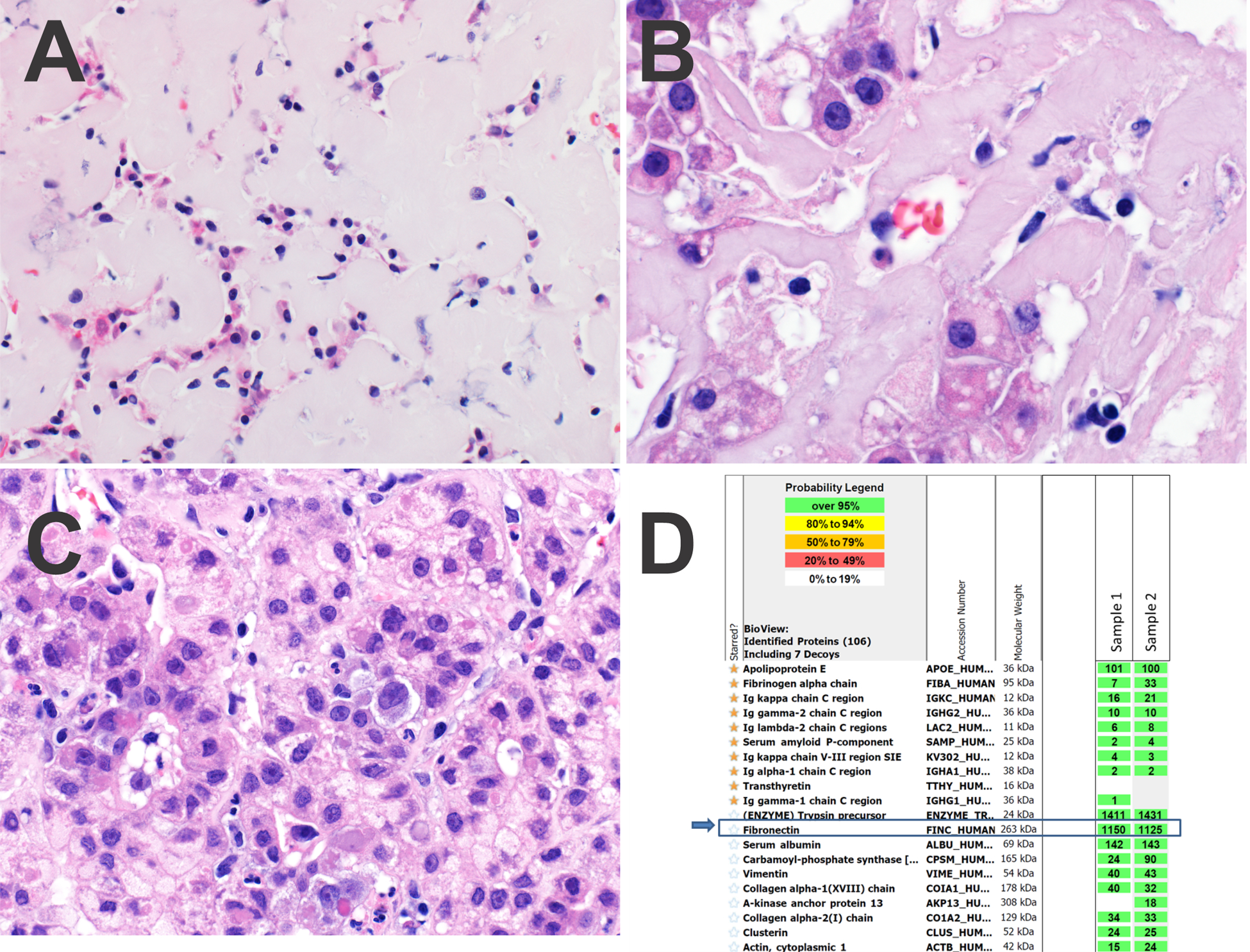 Figure 1, Case 1.