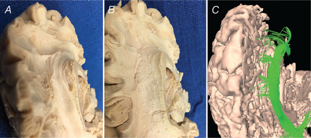 FIG. 11.