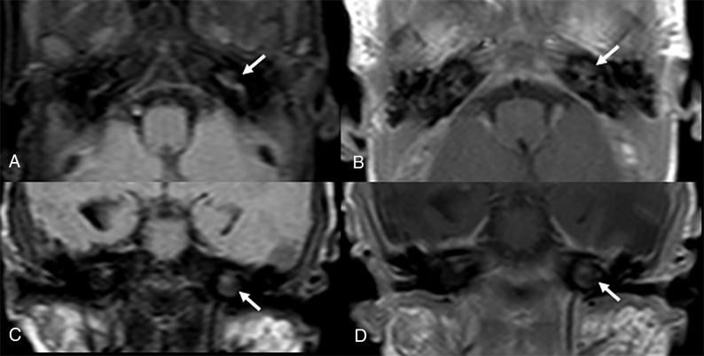 Fig 2.