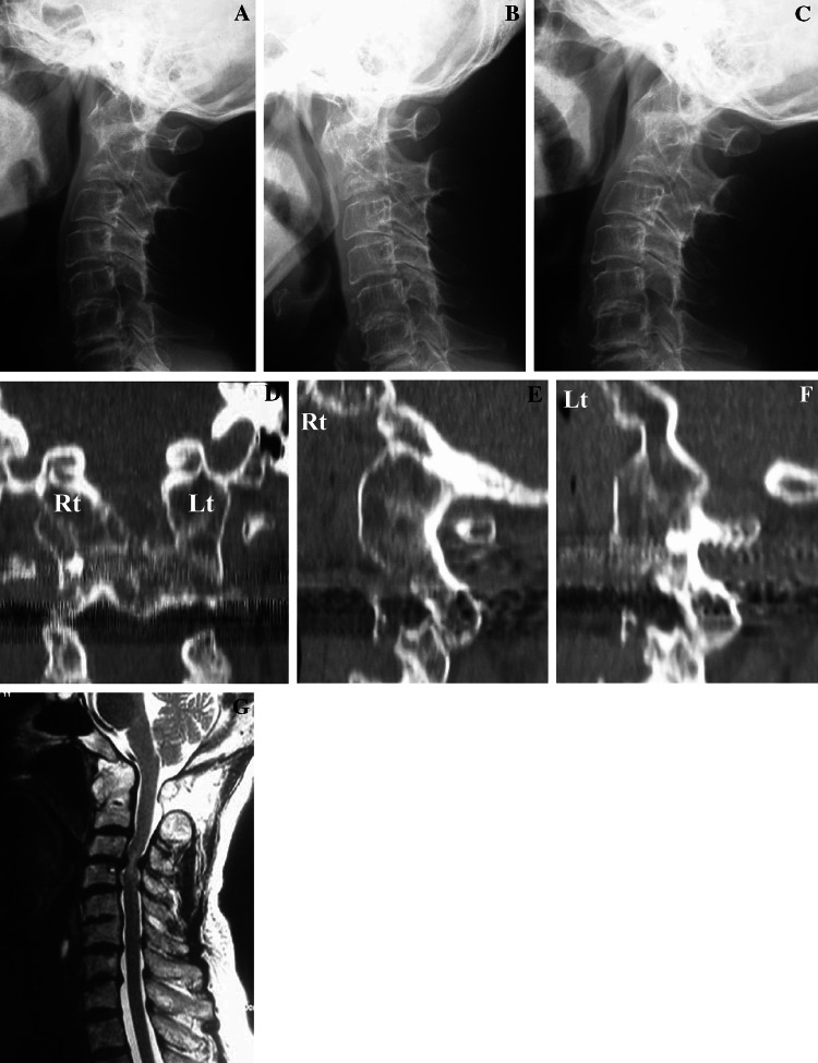 Fig. 3