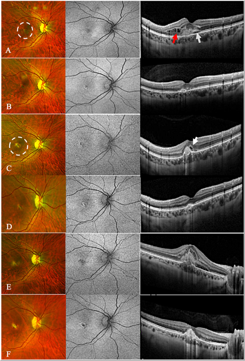 Fig. 1