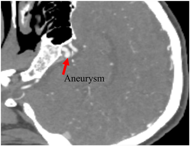 FIG. 1.