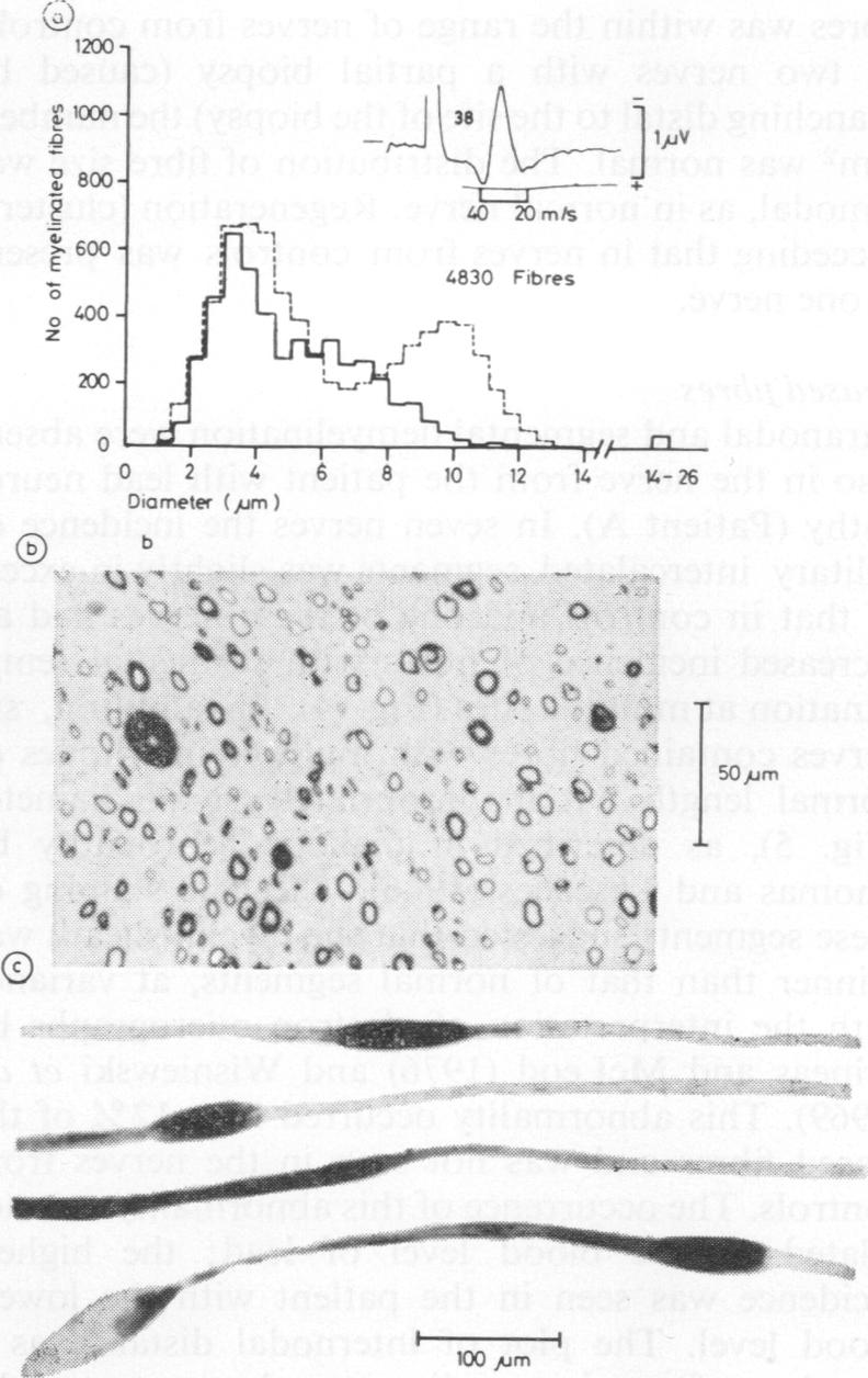 graphic file with name brjindmed00070-0057-a.jpg