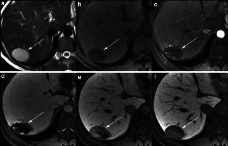 Fig. 4