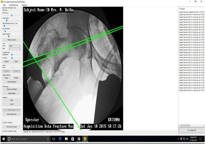 Fig. 1