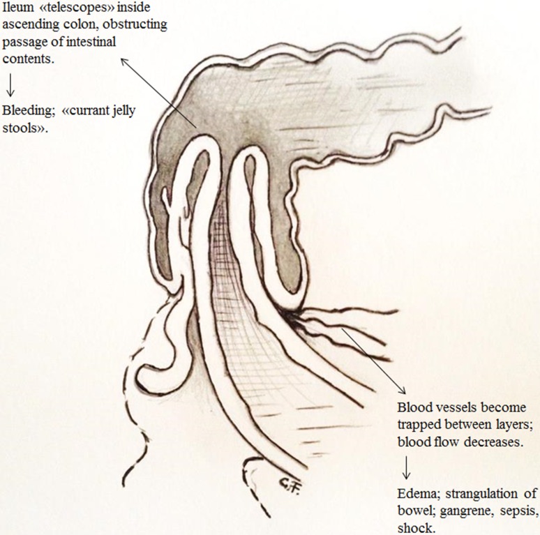 Fig. 1