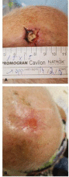 Fig. 6