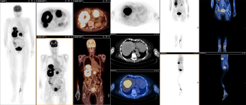 Fig. 1