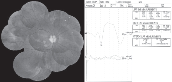 Figure 4