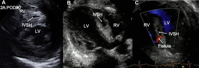 Figure 2