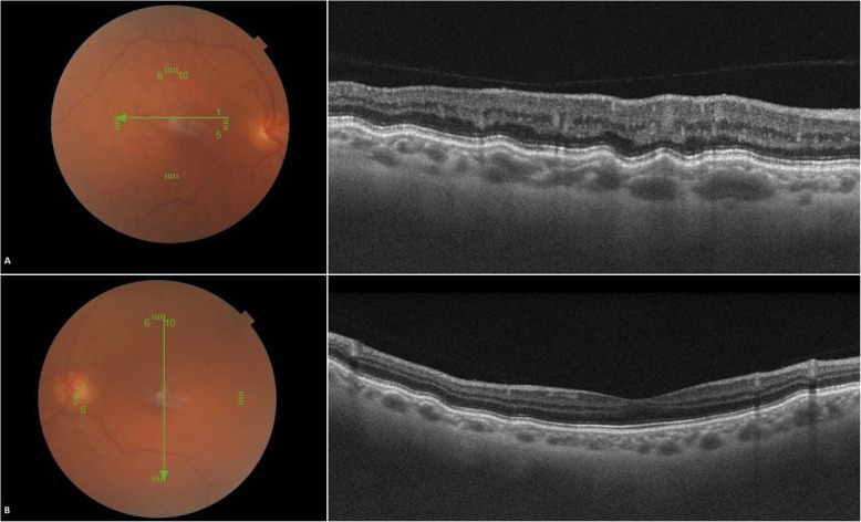 Fig. 4