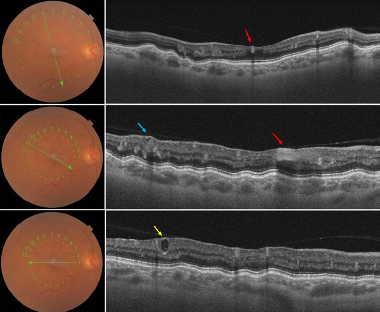 Fig. 3