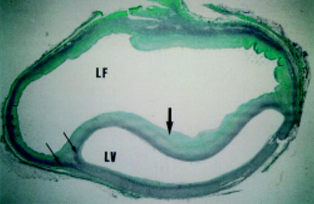 Figure 2  