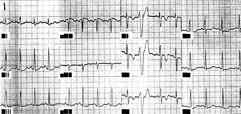 Figure 2:  