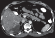 Figure 3b:
