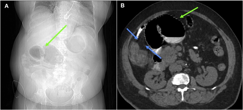 Fig. 1