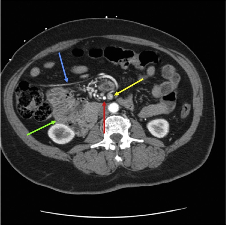 Fig. 4