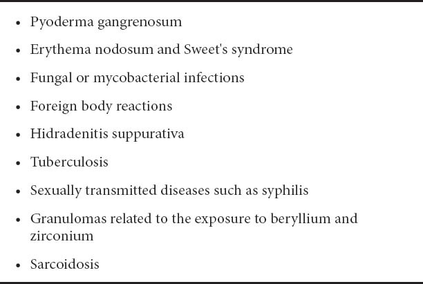 graphic file with name AnnGastroenterol-25-21-g004.jpg