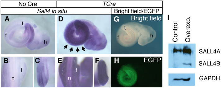 Normal Embryonic Development And Neonatal Digit Regeneration In Mice 