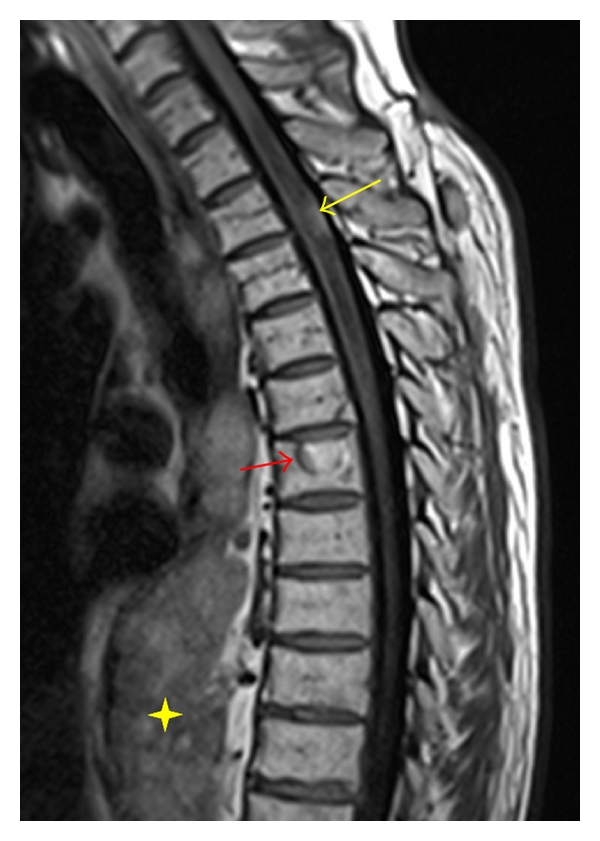 Figure 14