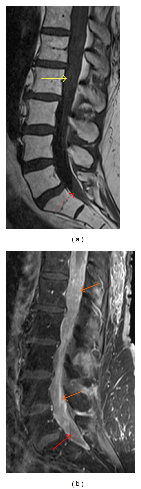 Figure 13