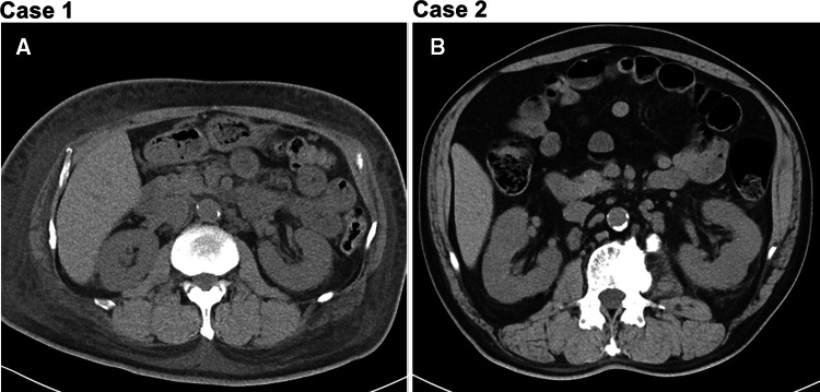 Fig. 1