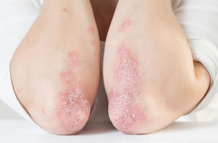 graphic file with name 15006_2021_304_Fig1_HTML.jpg