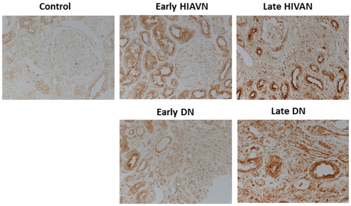 Figure 14