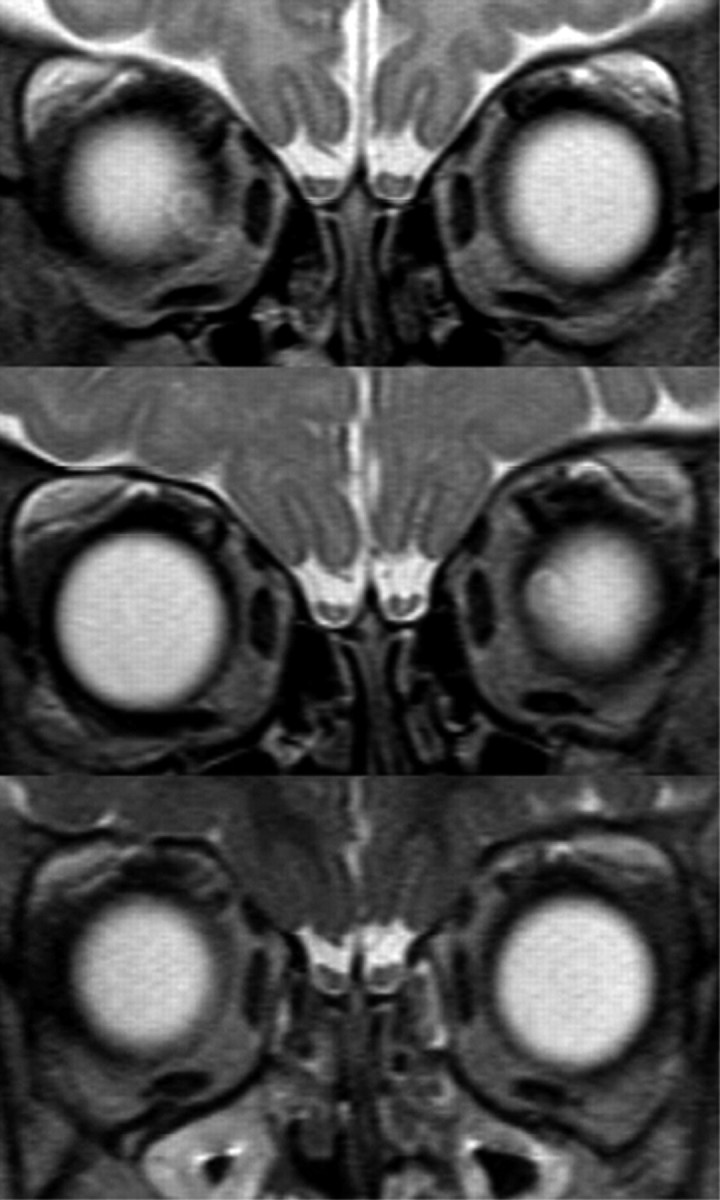 Fig 6.