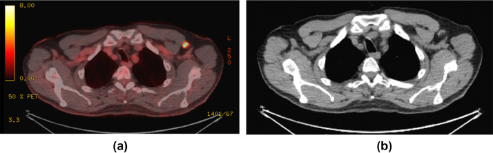 Fig. 1 –