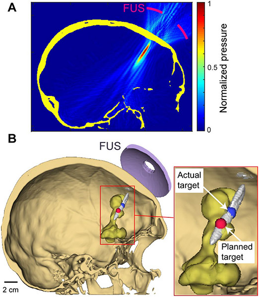 Fig.4.