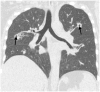 Figure1.