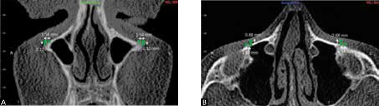 Figure 16