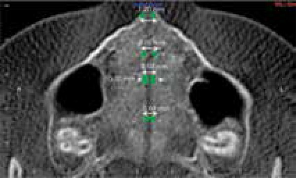 Figure 18