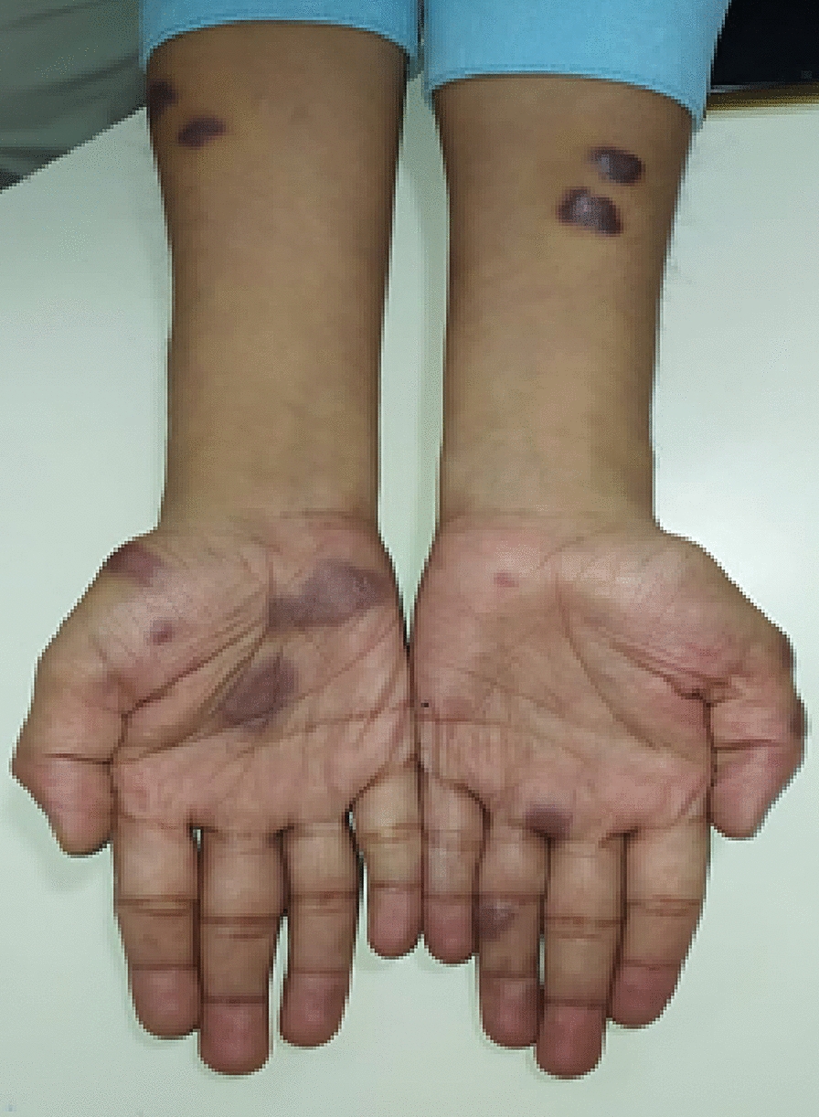 Fig. 4