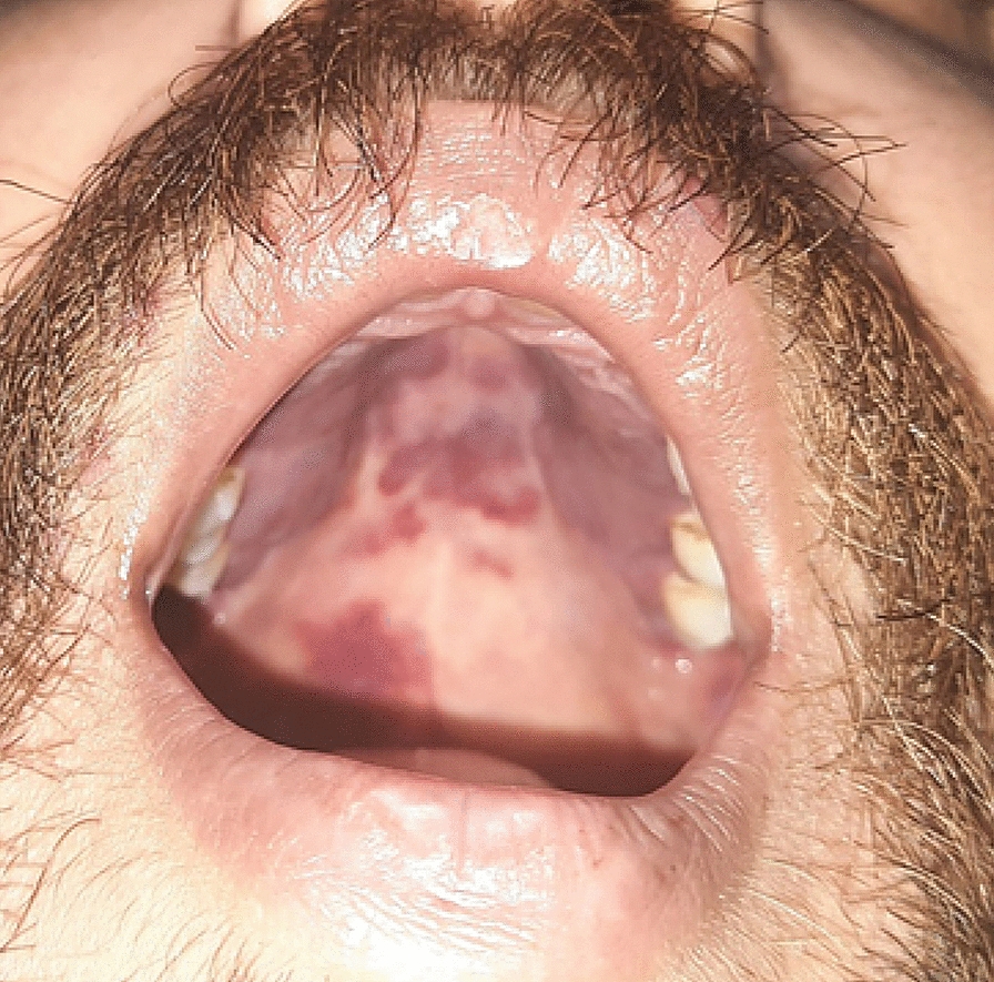 Fig. 3