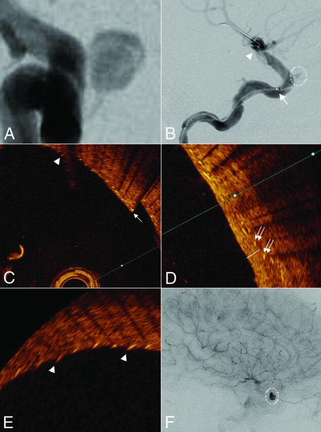 Fig 2.