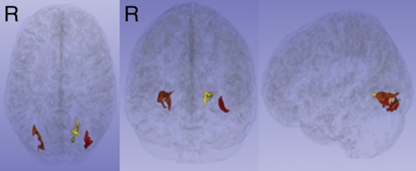 Figure 1a: