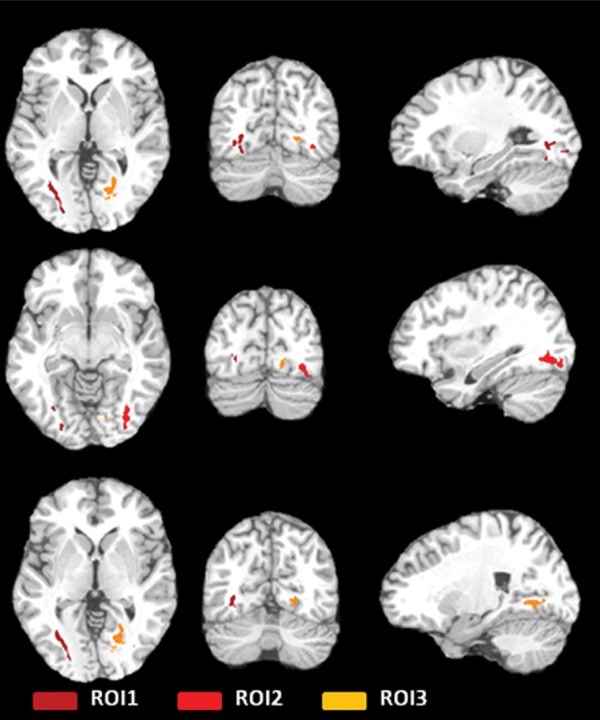 Figure 1b: