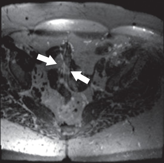 Figure 21a