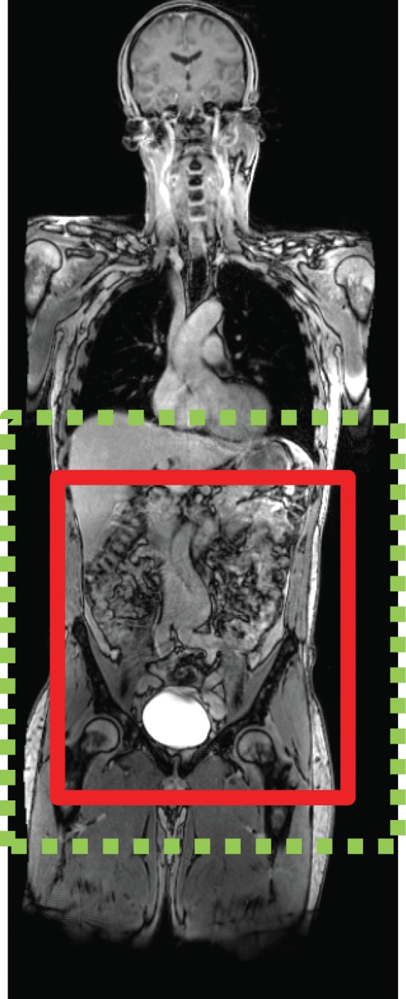 Figure 21c